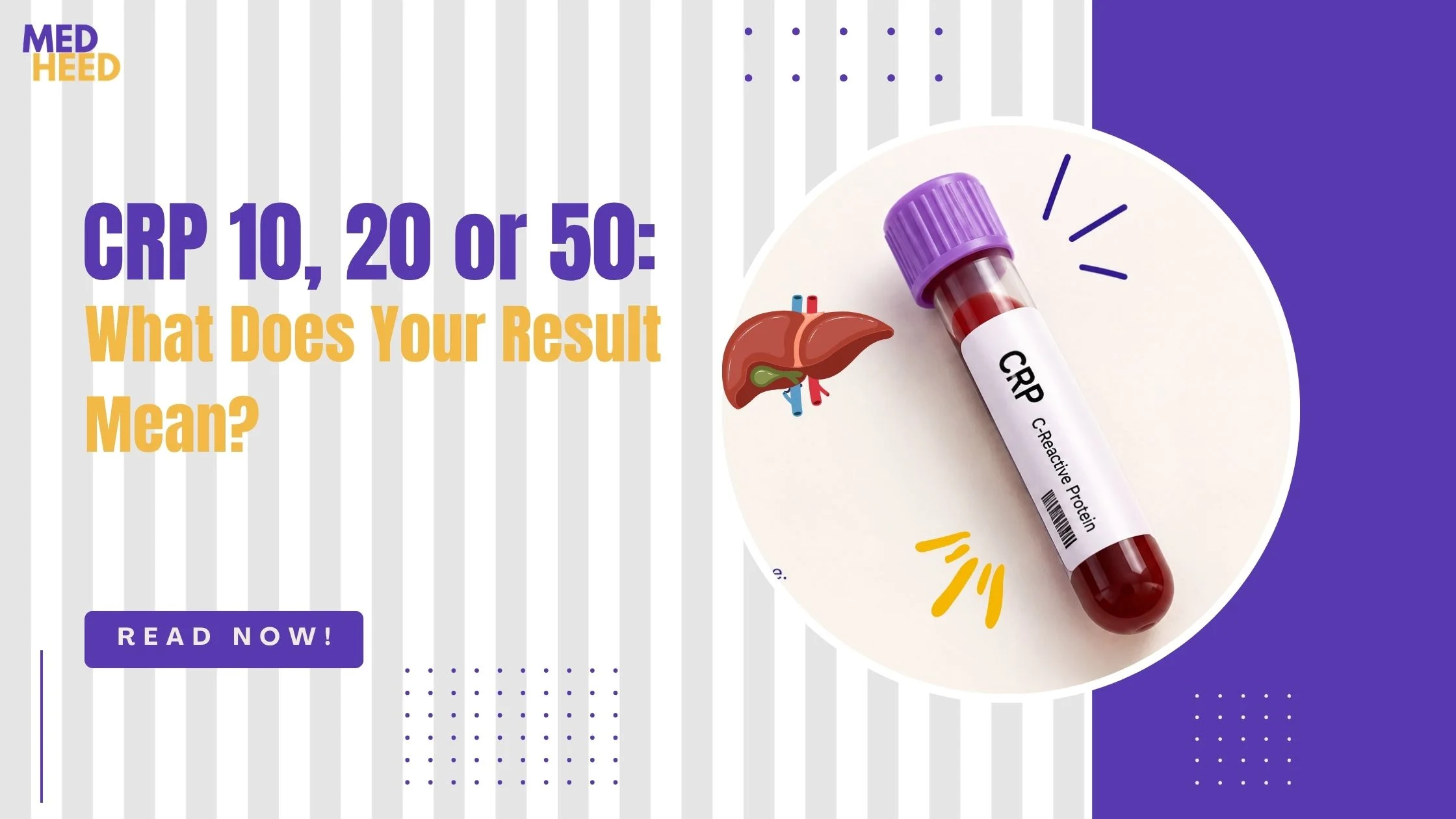 CRP levels meaning explained. Know what CRP 10, 20 or 50 mg/L says about infection and inflammation, and what to do next.